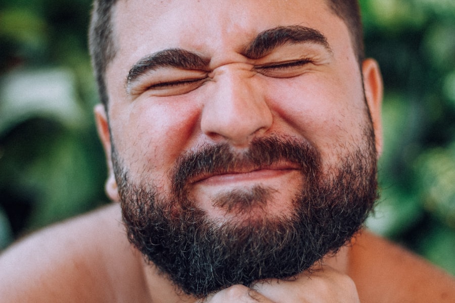 Beard Itch