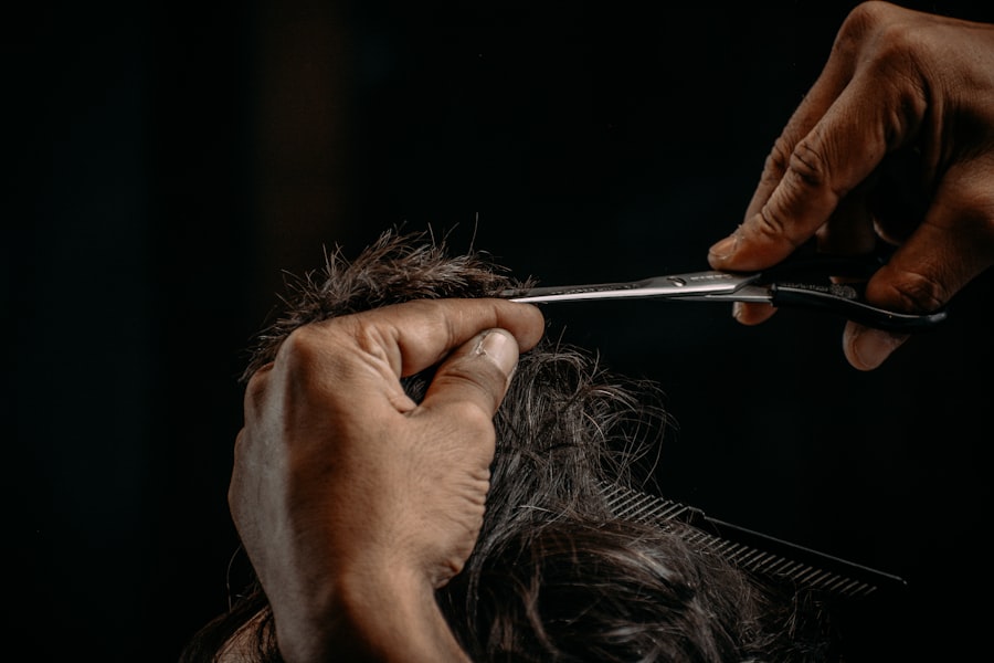 Photo Receding Hairline Stages