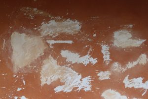 Photo Minoxidil Shedding Phase