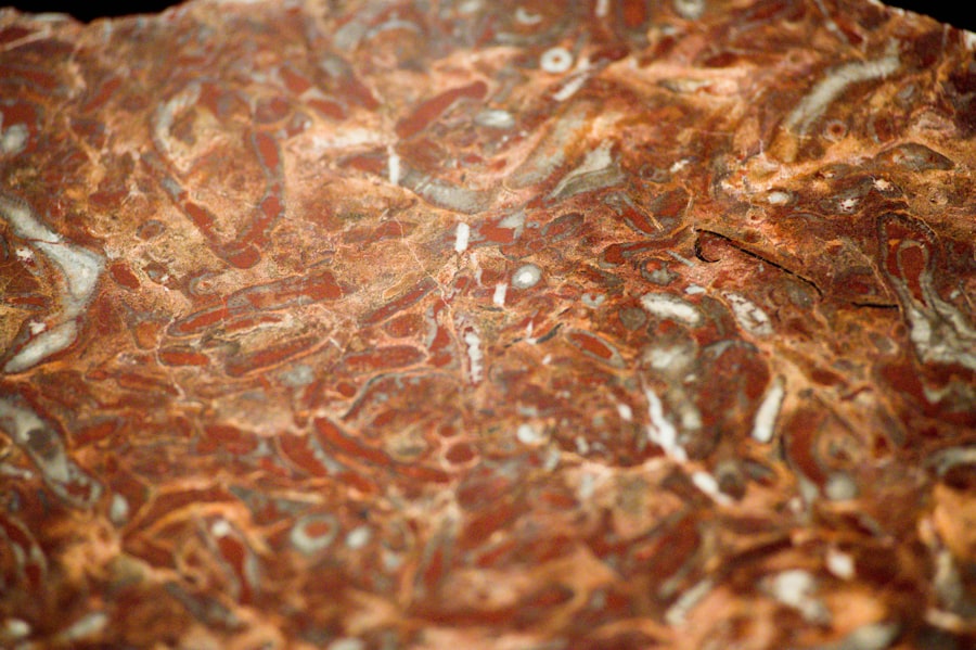 Photo Minoxidil Shedding Phase