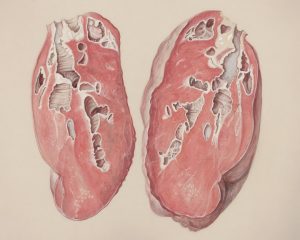 Photo Liver Tumor Evaluation