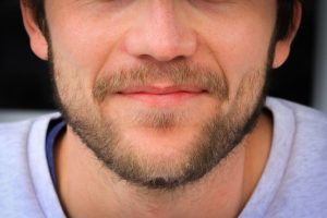 Photo Patchy Beard Causes